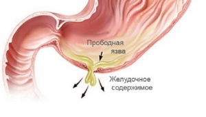 Приборы для альтернативной медицины