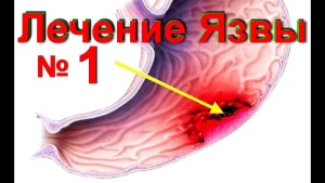 Рецепты супов при язве желудка и двенадцатиперстной кишки
