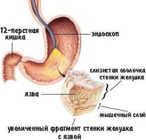 Лечение прополисом